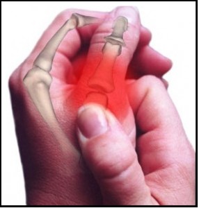 Osteoarthritis-Symptoms